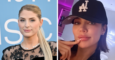 15 Before-And-After Photos Of Celebs Who Replaced Regular Botox With “Lip Flip” For A New Kind Of Look