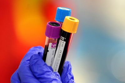 NHS push to stamp out ‘silent killer’ with at-home testing