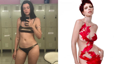 Julia Fox Before and After: Kanye West's Ex Opens Up About Plastic Surgery Regrets and New Outlook