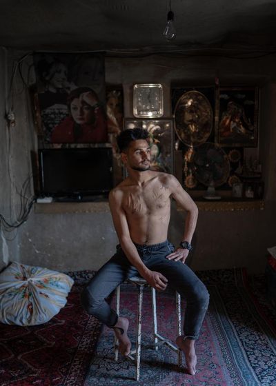 A man from Shiraz bares his scars: Shayan Sajadian’s best photograph