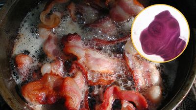 Diagnostic dilemma: A man's preference for 'soft' bacon may have given him brain worms