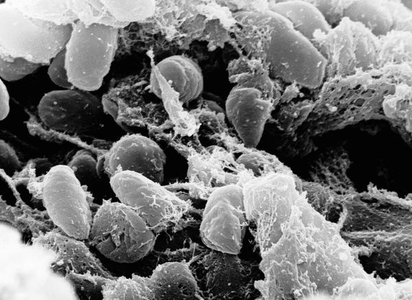 California resident tests positive for the plague after camping, officials say