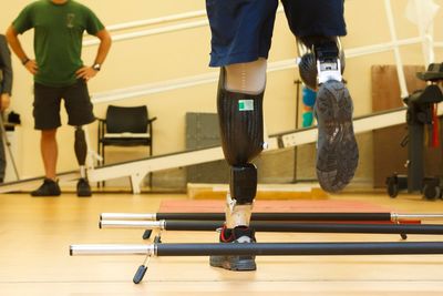 New software could reduce NHS waiting lists for prosthetic legs, study finds