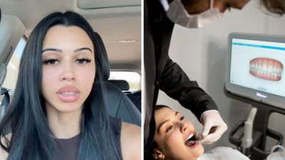 ‘There’s a reason why dentists don’t have veneers’: New Jersey woman gets veneers for $8K. Then her gums turn red