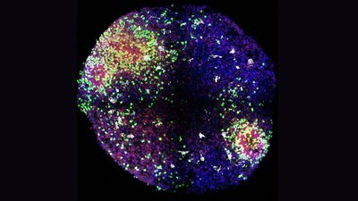 'Minibrains' reveal secrets of how key brain cells form in the womb