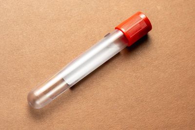Simple blood test could accurately detect ovarian cancer in its early stages
