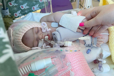 Lab-grown mini-lungs used to test new treatment for rare condition in babies