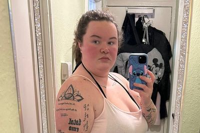 ‘I lost more than 2 stone on Mounjaro - but my hair started to fall out’