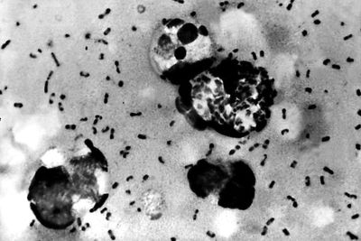 Plague patient was likely exposed to disease while camping