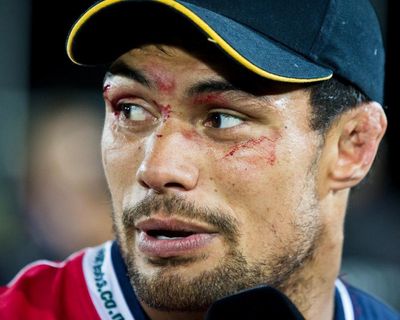 Shane Christie, rugby concussion campaigner who wanted to donate his brain, found dead at 39