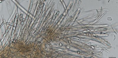 White mold fungi split their genome across several nuclei, with implications for future gene editing