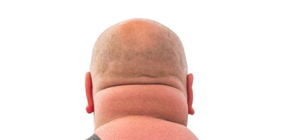 What your neck size reveals about your health