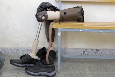 Scientists say we have been wrong about phantom limbs for decades