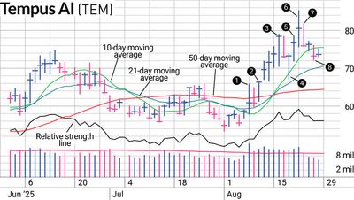 Tempus AI Stock Required A Tempered Position
