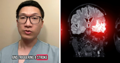 Neurologist Warns Against Popular Post-Exercise Habit That Could Trigger Strokes And Dementia