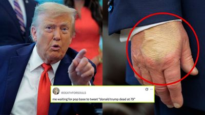 Social Media Theorists Are Convinced Donald Trump Is Dead After *Those* Viral Hand Pics