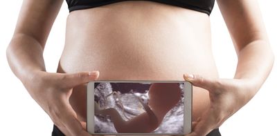 Microplastics, pregnancy and the placenta: what we know and what we don’t