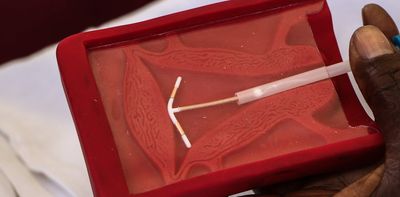 Birth control in Africa: study tracks the use of long-acting contraception in 26 countries