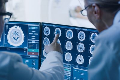 How AI could triple likelihood of stroke patients making full recovery