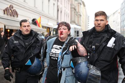 Ireland intervenes after Gaza activist national beaten by German police