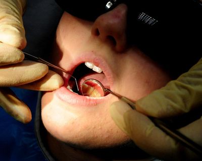 The Guardian view on the dental divide: ministers must brush up their policy as well as children’s teeth