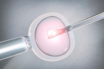 Co-IVF pregnancies may boost risk of serious complications, study suggests