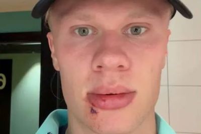 Erling Haaland 'blames Martin Odegaard' for freak injury suffered on international duty