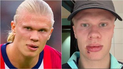 Erling Haaland Brilliantly Blames Premier League Rival After Freak Accident