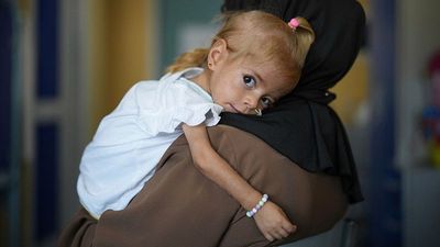 Gaza toddler evacuated to Italy shows signs of recovery from rare disease and severe malnutrition