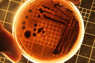 Meal Delivery Service Recall: Salmonella Outbreak Sickens 16, CDC Warns of More Cases