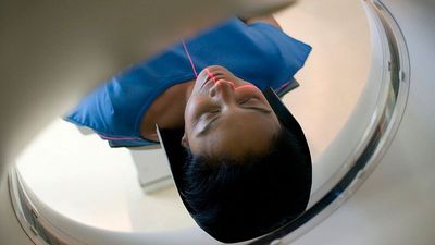 CT scans ahead of pregnancy may raise risks of poor birth outcomes, study finds