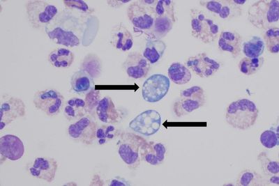 Warning over rise in cases of deadly ‘brain-eating’ amoeba infections in Kerala