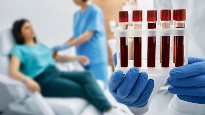 This simple blood test could revolutionise Alzheimer’s diagnosis, say UK researchers
