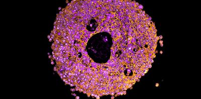 3D printed mini-placentas offer a new way to study pregnancy complications