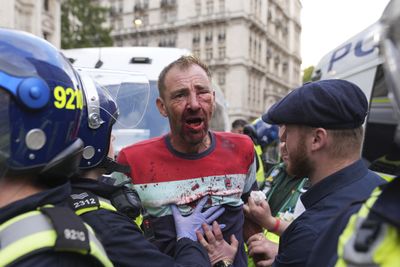 Clashes in London as 110,000 join far-right rally against immigration