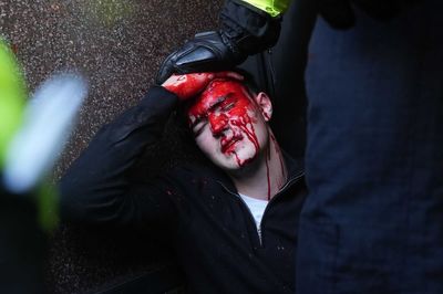 Most shocking moments from Tommy Robinson's 'Unite the Kingdom' rally