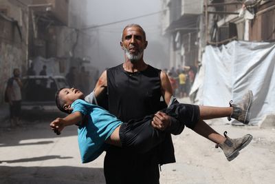 Foreign doctors say Israel systematically targeting Gaza’s children: Report