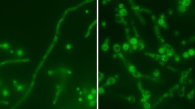 'Russian nesting doll' virus hides inside a deadly fungus, making it even more dangerous to people
