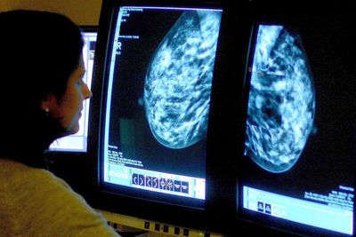 How routine breast screenings could help predict heart problems