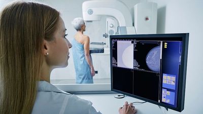 This new AI tool can predict women’s heart health risks with mammograms