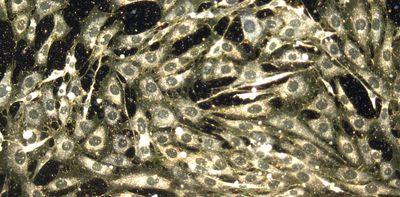 Your immune system attacks drugs like it does viruses – paradoxically offering a way to improve cancer treatment