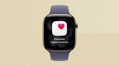 Apple just gave millions of Watch users a health upgrade you won’t want to ignore