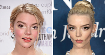 29 Celebrities Fans Believe Ruined Their Beauty With Buccal Fat Removal