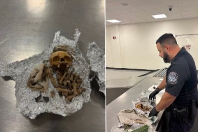 Human skull and bones discovered in passenger’s luggage at Florida airport