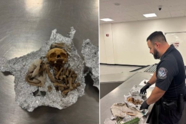 Human skull and bones discovered in passenger’s luggage at Florida airport