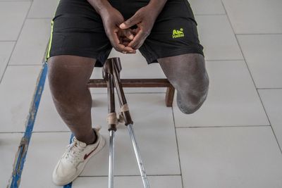 Photos of an orthopedic center in Congo that helps amputees regain mobility