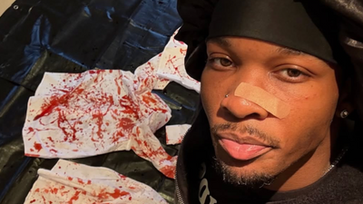 D4vd 'Bloody Shirt' Issue Explained - Has Rapper Released A Statement?
