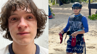 Tom Holland Injury: Photos and Fan Reactions After Concussion Halts Filming for New Spider-Man Movie