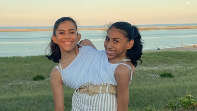Conjoined twin and her husband balance intimacy with her sister’s boundaries, but she does not care
