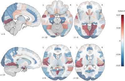 Cycling might help prevent the onset of dementia, new study finds